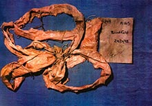 ‘Bands of Death’ Mark the 26th Anniversary of the Genocide in Srebrenica